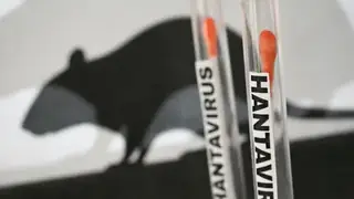 İspanya'da Hanta Virüsü Vakası Tespit Edildi