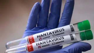 Dünya Sağlık Örgütü'nden Hanta Virüsü Açıklaması: Risk Çok Düşük
