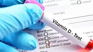 Uzmanından D Vitamini Uyarısı: Bilinçsiz Kullanım Böbrek Taşına Yol Açıyor