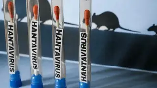 Avrupa Birliği, Hanta virüsü görülen yolcu gemisini tahliye etmek için uçak gönderiyor