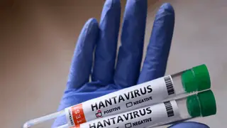 Kanada'da Hantavirüs Vakası Tespit Edildi