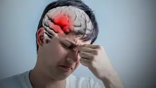 Yeni deneysel ilac beyin damar tıkanıklığına baglı inme riskini azaltıyor